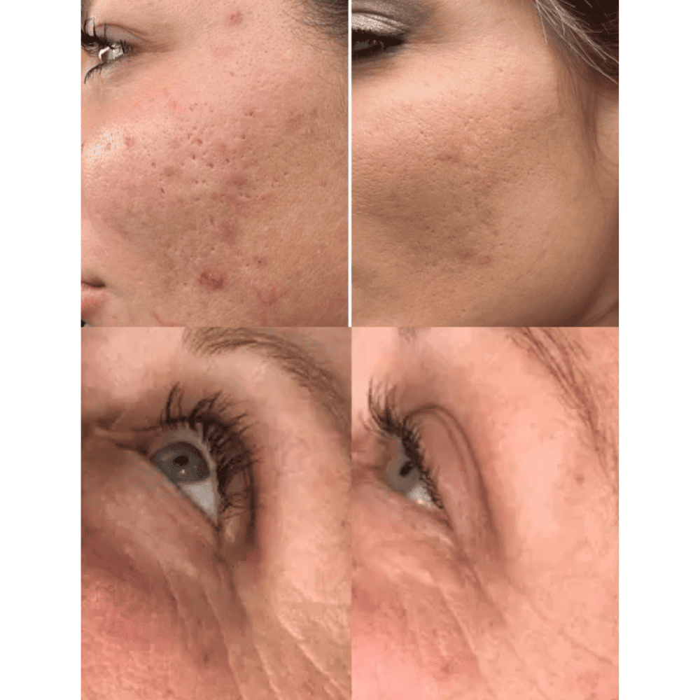 FaceLift Lumive – 7-Colour LED Therapy Mask