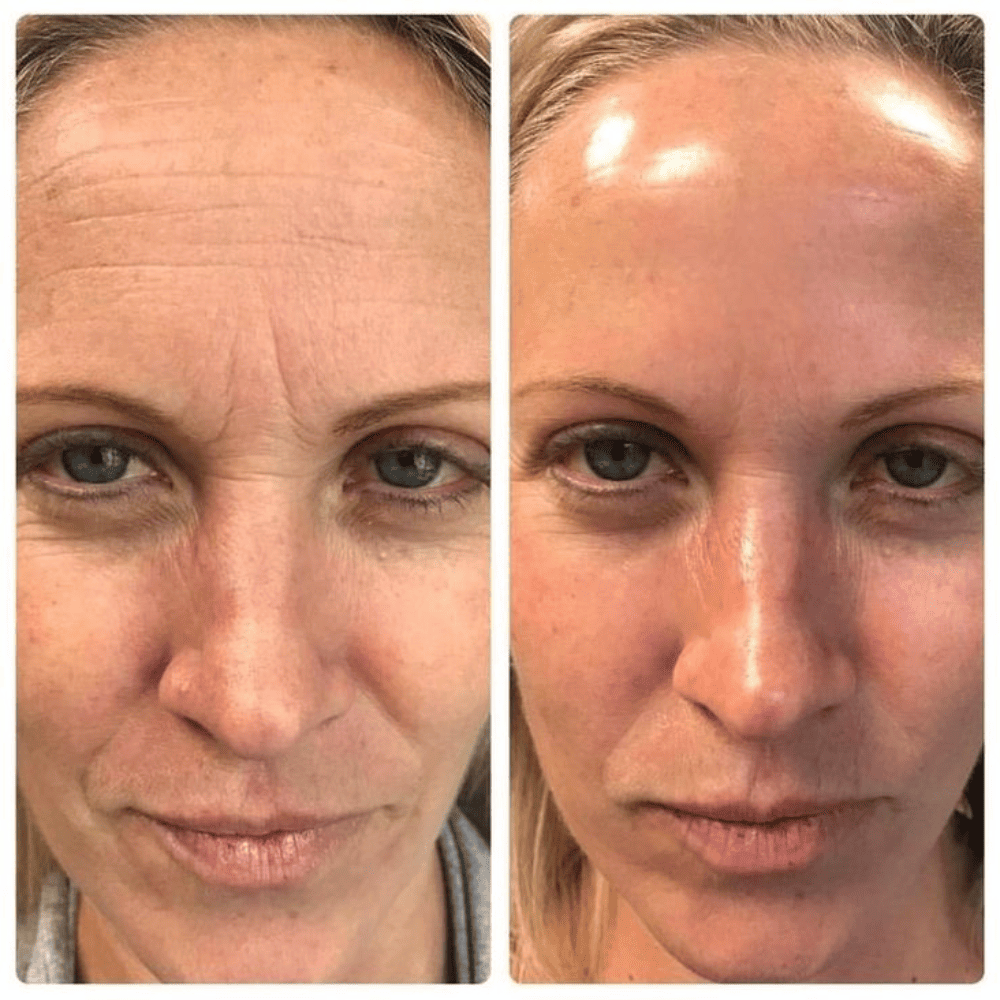 Facial Massager with Anti-Wrinkle Phototherapy - Lumieve