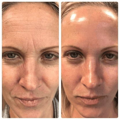Facial Massager with Anti-Wrinkle Phototherapy - Lumieve