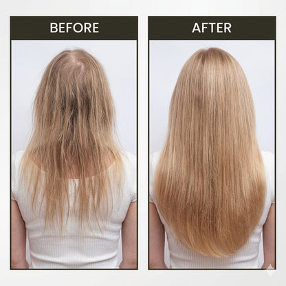LumiGrow Pro – Therapeutic Scalp Massager